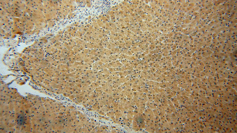 Immunohistochemical of paraffin-embedded human liver using Catalog No:111183(GSTCD antibody) at dilution of 1:100 (under 10x lens)