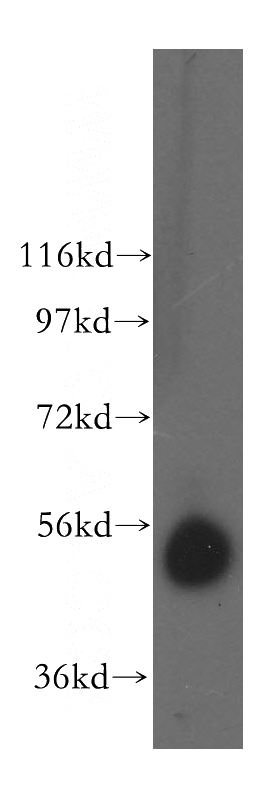 human kidney tissue were subjected to SDS PAGE followed by western blot with Catalog No:108933(CAP2 antibody) at dilution of 1:400
