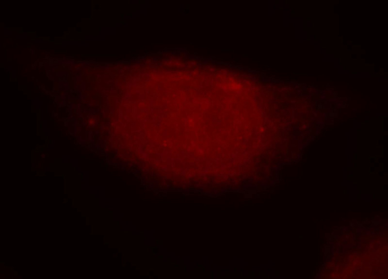Immunofluorescent analysis of Hela cells, using SOX13 antibody Catalog No:115511 at 1:50 dilution and Rhodamine-labeled goat anti-rabbit IgG (red).