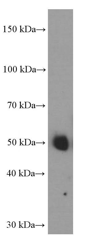 human testis tissue were subjected to SDS PAGE followed by western blot with Catalog No:107348(INHBA-Specific Antibody) at dilution of 1:1000