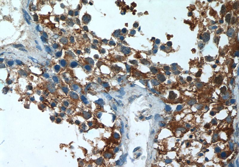 Immunohistochemistry of paraffin-embedded human testis tissue slide using Catalog No:107913(AGA Antibody) at dilution of 1:50 (under 40x lens)