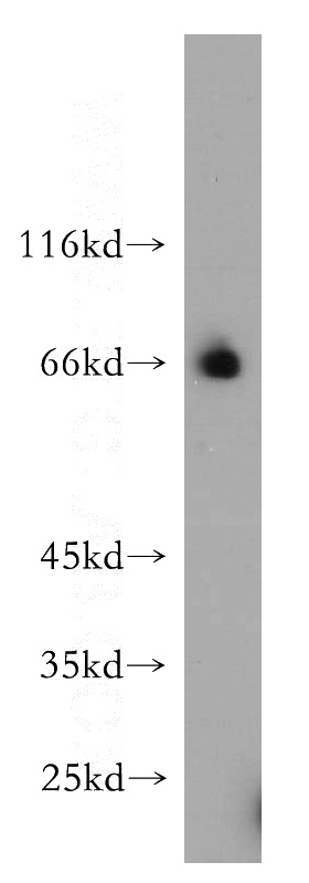 HepG2 cells were subjected to SDS PAGE followed by western blot with Catalog No:114614(RBM42 antibody) at dilution of 1:500