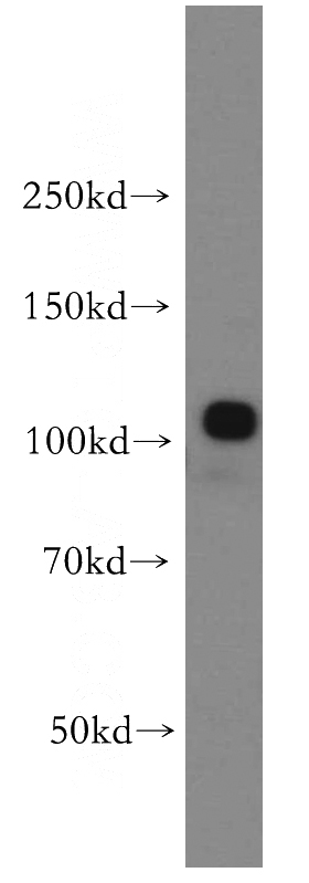 mouse brain tissue were subjected to SDS PAGE followed by western blot with Catalog No:108101(ANO2 antibody) at dilution of 1:500