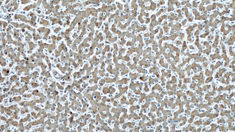 Immunohistochemical of paraffin-embedded human liver using Catalog No:111806(NOS2 antibody) at dilution of 1:50 (under 10x lens)