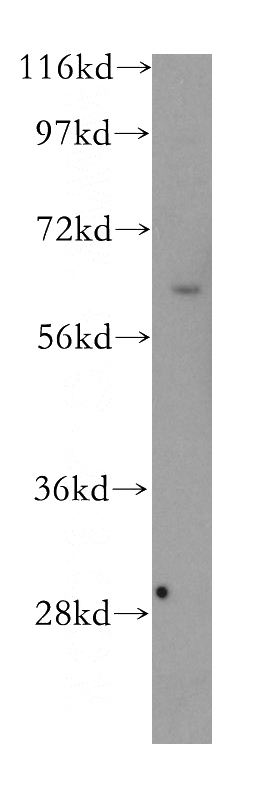Jurkat cells were subjected to SDS PAGE followed by western blot with Catalog No:107901(MLLT3 antibody) at dilution of 1:600