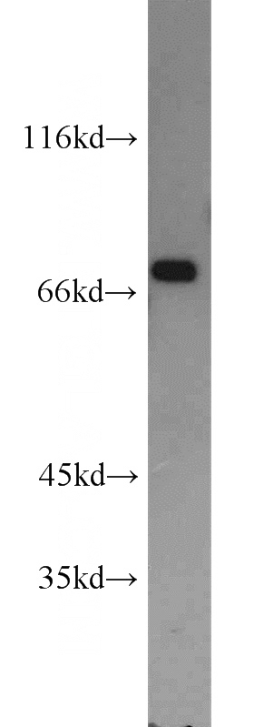 HeLa cells were subjected to SDS PAGE followed by western blot with Catalog No:108284(ATF2-Specific antibody) at dilution of 1:600