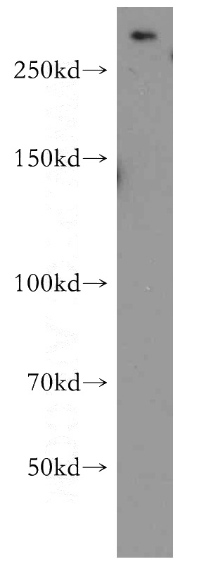 HeLa cells were subjected to SDS PAGE followed by western blot with Catalog No:112792(MTOR antibody) at dilution of 1:500