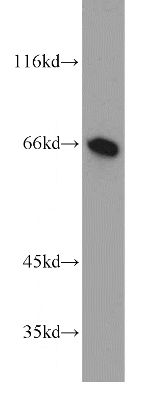 human kidney tissue were subjected to SDS PAGE followed by western blot with Catalog No:116657(UBP1 antibody) at dilution of 1:1000
