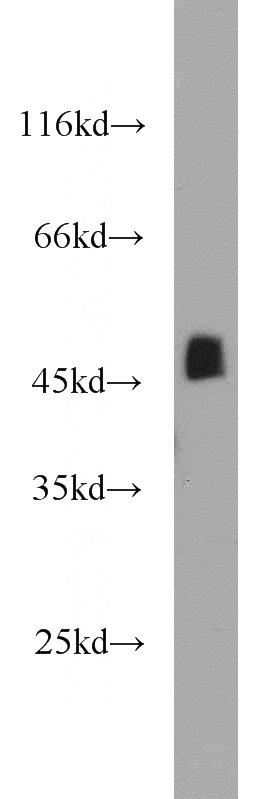 mouse skeletal muscle tissue were subjected to SDS PAGE followed by western blot with Catalog No:115272(SHF antibody) at dilution of 1:1000