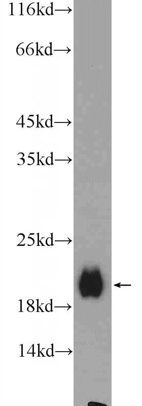 mouse brain tissue were subjected to SDS PAGE followed by western blot with Catalog No:109260(Centrin 2 Antibody) at dilution of 1:600
