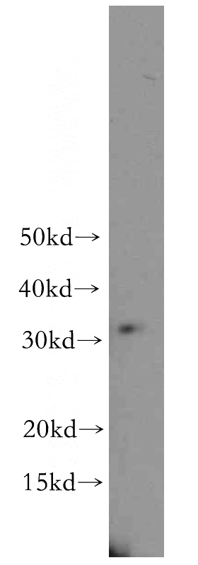 PC-3 cells were subjected to SDS PAGE followed by western blot with Catalog No:114021(PMEPA1 antibody) at dilution of 1:300