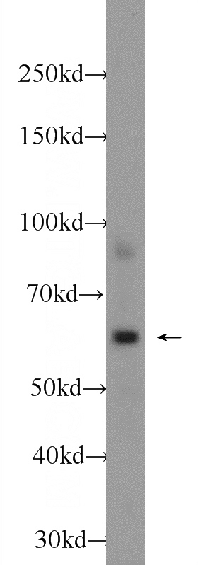 HeLa cells were subjected to SDS PAGE followed by western blot with Catalog No:115279(PTPN6 Antibody) at dilution of 1:1000