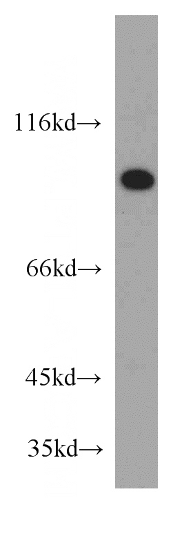 HeLa cells were subjected to SDS PAGE followed by western blot with Catalog No:115753(SUZ12 antibody) at dilution of 1:500