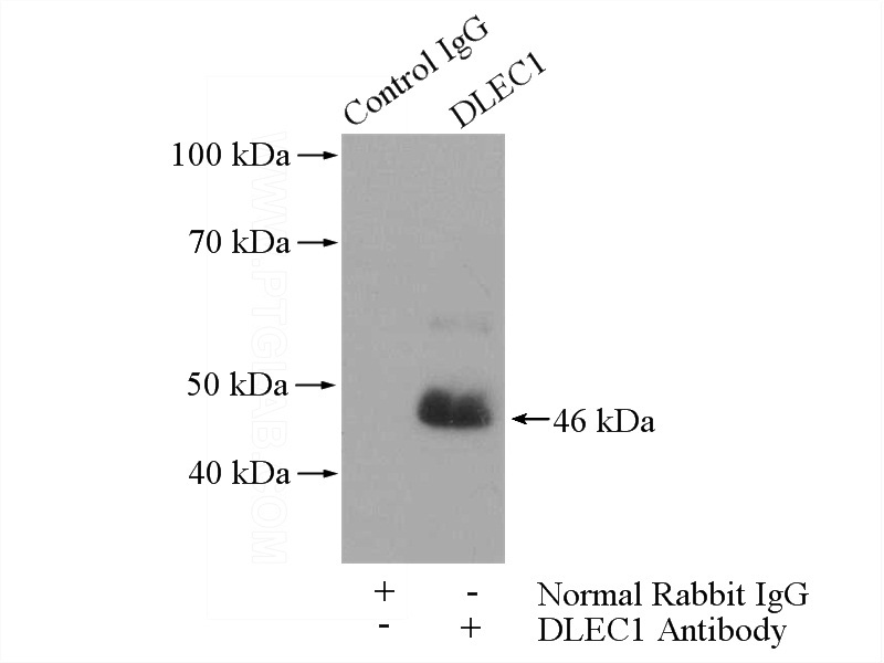 IP Result of anti-DLEC1 (IP:Catalog No:109988, 4ug; Detection:Catalog No:109988 1:300) with PC-3 cells lysate 1100ug.