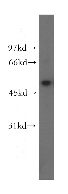 PC-3 cells were subjected to SDS PAGE followed by western blot with Catalog No:116670(UBXN11 antibody) at dilution of 1:500