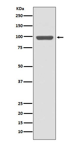 Western blot analysis of Insulin Receptor expression in HeLa cell lysate.