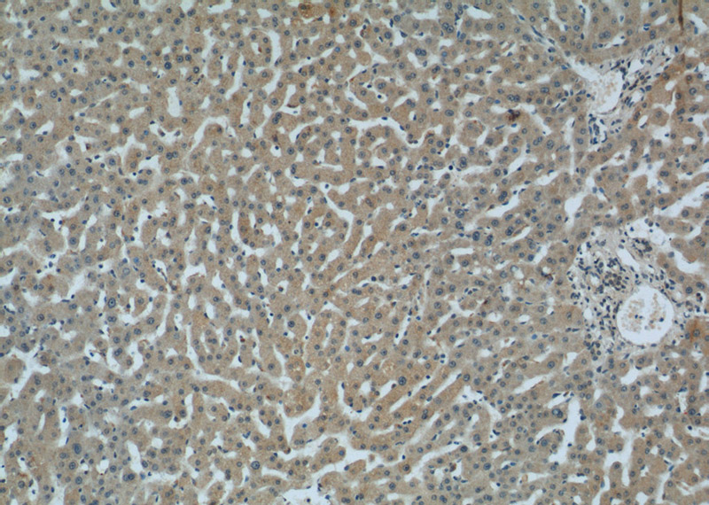 Immunohistochemistry of paraffin-embedded human liver tissue slide using Catalog No:108687(C1QC Antibody) at dilution of 1:50 (under 10x lens)