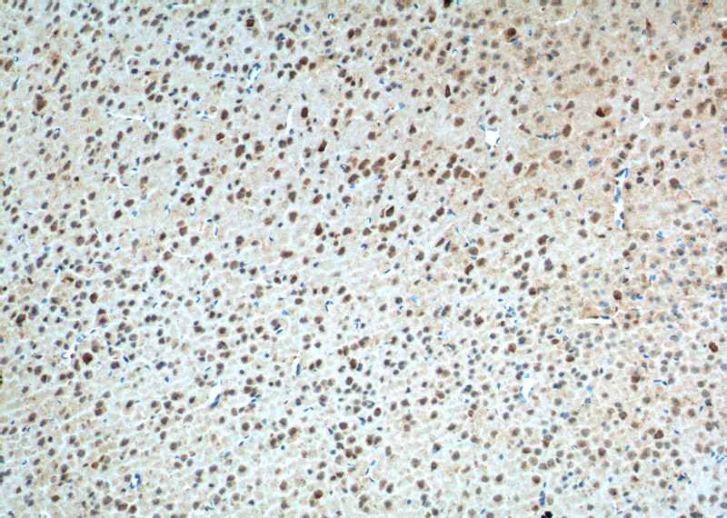 Immunohistochemistry of paraffin-embedded mouse brain tissue slide using Catalog No:107784(ADORA1 Antibody) at dilution of 1:200 (under 10x lens). heat mediated antigen retrieved with Tris-EDTA buffer(pH9).