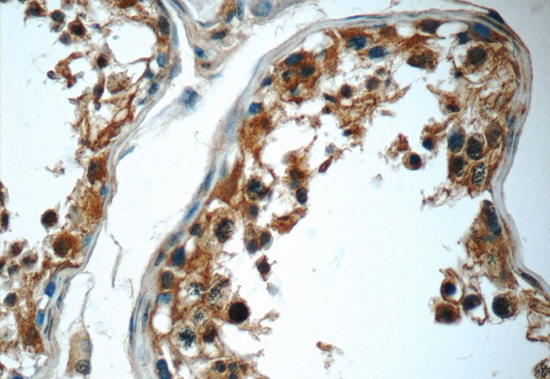 Immunohistochemistry of paraffin-embedded human testis tissue slide using Catalog No:108717(C2orf67 Antibody) at dilution of 1:50 (under 40x lens)