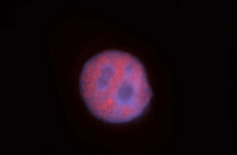 Immunofluorescent analysis of HepG2 cells, using HNRNPUL1 antibody Catalog No:111514 at 1:50 dilution and Rhodamine-labeled goat anti-rabbit IgG (red). Blue pseudocolor = DAPI (fluorescent DNA dye).