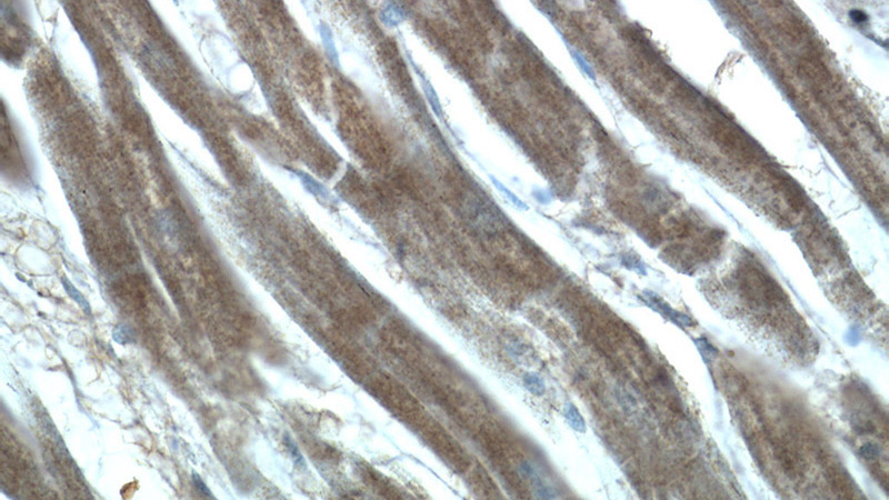 Immunohistochemistry of paraffin-embedded human heart tissue slide using Catalog No:111248(GUCY1A3 Antibody) at dilution of 1:50 (under 40x lens)