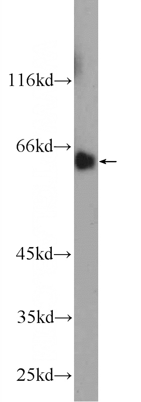mouse liver tissue were subjected to SDS PAGE followed by western blot with Catalog No:112771(MTF1 Antibody) at dilution of 1:1000