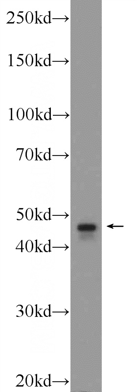mouse testis tissue were subjected to SDS PAGE followed by western blot with Catalog No:115874(TBCEL Antibody) at dilution of 1:3000