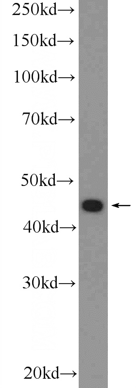 PC-3 cells were subjected to SDS PAGE followed by western blot with Catalog No:117035(ZDHHC7 Antibody) at dilution of 1:1000