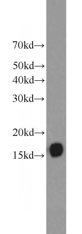 human brain tissue were subjected to SDS PAGE followed by western blot with Catalog No:117188(BLoc1S1-Specific antibody) at dilution of 1:1000