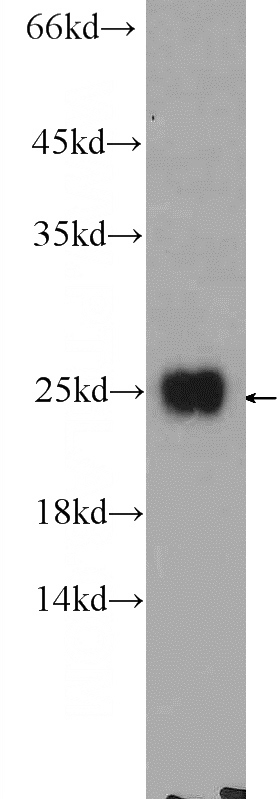 HeLa cells were subjected to SDS PAGE followed by western blot with Catalog No:108963(CCDC12 Antibody) at dilution of 1:600