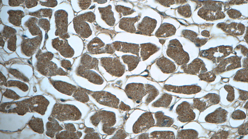 Immunohistochemistry of paraffin-embedded human heart tissue slide using Catalog No:116599(USP21 Antibody) at dilution of 1:50 (under 40x lens)