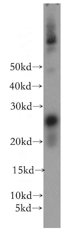 Jurkat cells were subjected to SDS PAGE followed by western blot with Catalog No:113337(OIP5 antibody) at dilution of 1:500