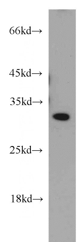 HepG2 cells were subjected to SDS PAGE followed by western blot with Catalog No:115235(SIP1 antibody) at dilution of 1:500