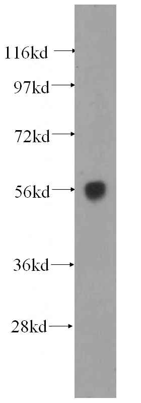 Jurkat cells were subjected to SDS PAGE followed by western blot with Catalog No:109952(DNAJC7 antibody) at dilution of 1:500
