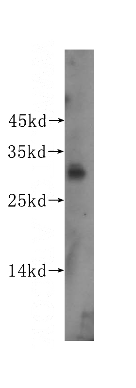 human heart tissue were subjected to SDS PAGE followed by western blot with Catalog No:111791(ING1-specific antibody) at dilution of 1:300