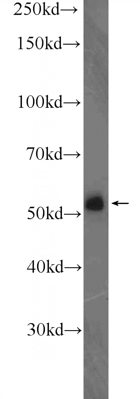 mouse lung tissue were subjected to SDS PAGE followed by western blot with Catalog No:112044(KIAA0141 Antibody) at dilution of 1:300
