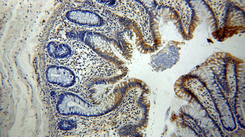Immunohistochemical of paraffin-embedded human colon using Catalog No:112095(KLHL18 antibody) at dilution of 1:100 (under 10x lens)