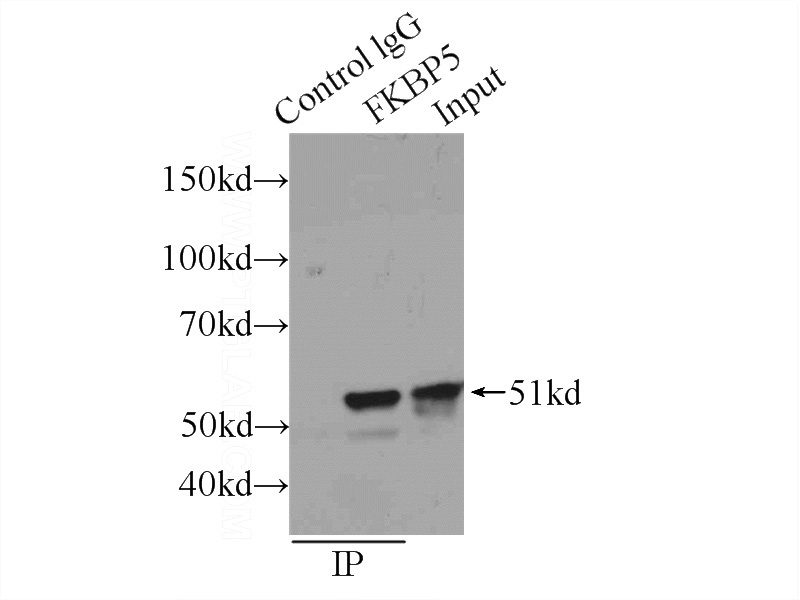 IP Result of anti-FKBP5 (IP:Catalog No:110675, 3ug; Detection:Catalog No:110675 1:1000) with K-562 cells lysate 1500ug.