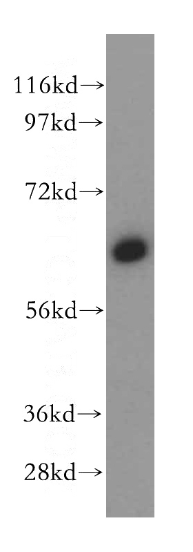 HeLa cells were subjected to SDS PAGE followed by western blot with Catalog No:108918(CAMK2D antibody) at dilution of 1:500