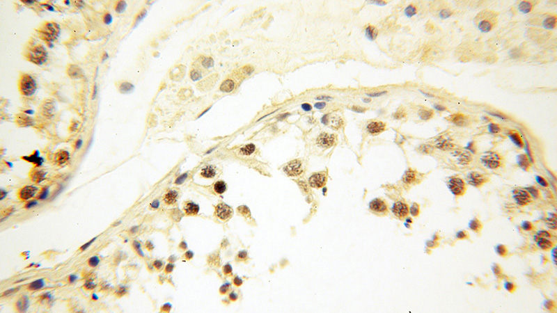 Immunohistochemical of paraffin-embedded human testis using Catalog No:115666(NCOA1 antibody) at dilution of 1:100 (under 40x lens)