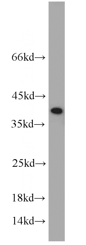 COLO 320 cells were subjected to SDS PAGE followed by western blot with Catalog No:116462(U2AF35 antibody) at dilution of 1:1000