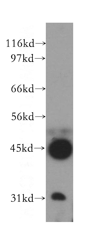 MCF7 cells were subjected to SDS PAGE followed by western blot with Catalog No:114209(PRMT8 antibody) at dilution of 1:400
