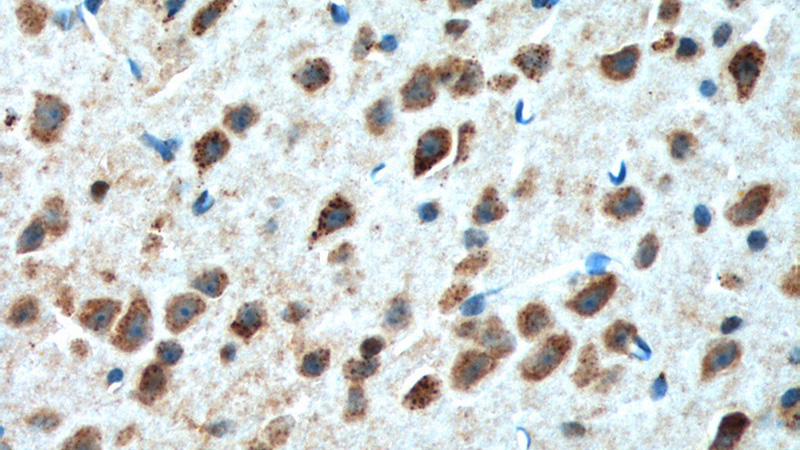Immunohistochemistry of paraffin-embedded mouse brain tissue slide using Catalog No:107784(ADORA1 Antibody) at dilution of 1:200 (under 40x lens). heat mediated antigen retrieved with Tris-EDTA buffer(pH9).