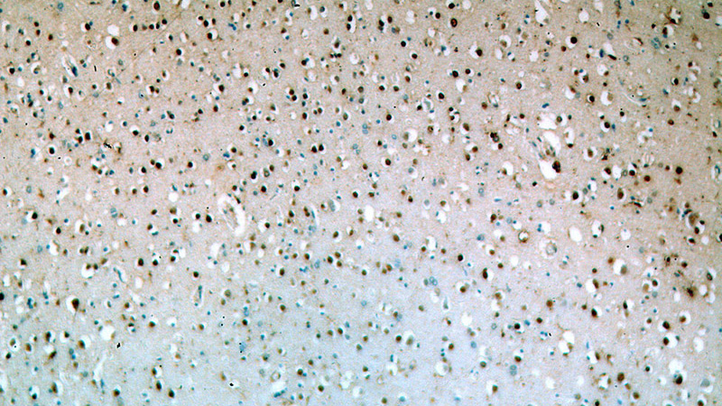 Immunohistochemical of paraffin-embedded human brain using Catalog No:117163(ZNF34 antibody) at dilution of 1:50 (under 10x lens)