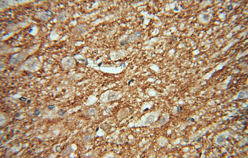Immunohistochemical of paraffin-embedded human brain using Catalog No:108743(CA11 antibody) at dilution of 1:50 (under 40x lens)