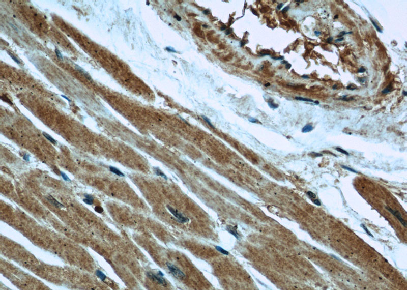 Immunohistochemical of paraffin-embedded human heart using Catalog No:107239(DES antibody) at dilution of 1:50 (under 40x lens)