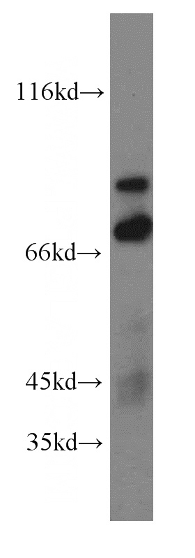 mouse small intestine tissue were subjected to SDS PAGE followed by western blot with Catalog No:116302(TRIM2 antibody) at dilution of 1:500