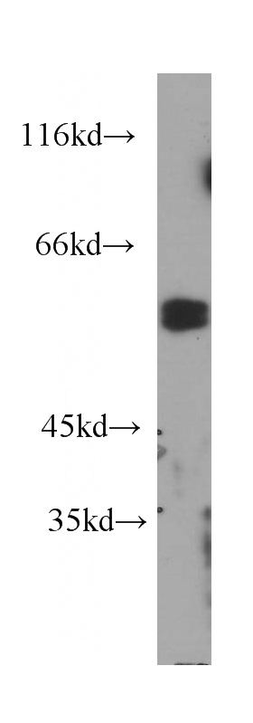 Jurkat cells were subjected to SDS PAGE followed by western blot with Catalog No:107049(CD2 antibody) at dilution of 1:400