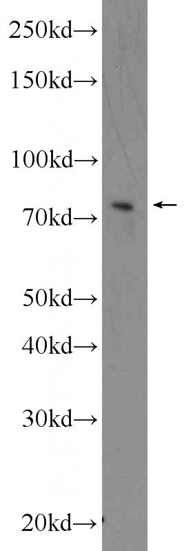 U-937 cells were subjected to SDS PAGE followed by western blot with Catalog No:107762(ADAM17 Antibody) at dilution of 1:600