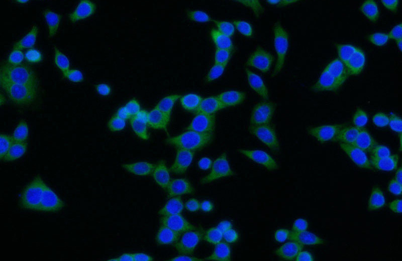 Immunofluorescent analysis of BxPC-3 cells using Catalog No:108149(ARMC3 Antibody) at dilution of 1:25 and Alexa Fluor 488-congugated AffiniPure Goat Anti-Rabbit IgG(H+L)